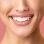 Benefits of Porcelain Veneers for a Bright Smile
