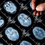 Brain Cancer Treatment Options