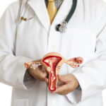Impact of Fibroids