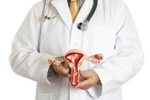 Impact of Fibroids
