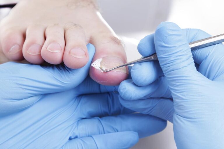 When Is a Podiatrist Needed for Toenail Issues?